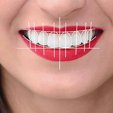 smile-designing