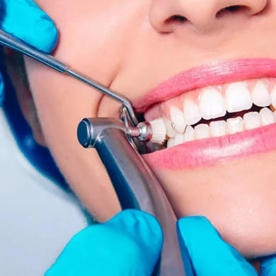 teeth-cleaning